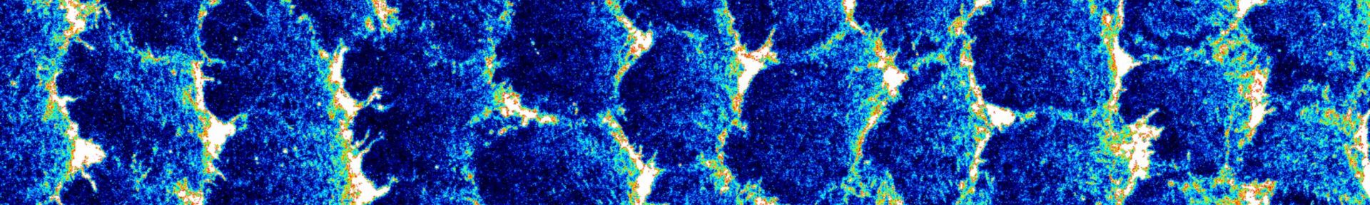 MAX_210916_DyssfGFP-Atto550-DAPI-02-1_LUT-Royal(1)