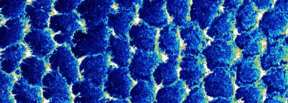 MAX_210916_DyssfGFP-Atto550-DAPI-02-1_LUT-Royal(1)